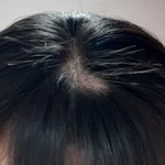 [댓글부탁해] ㅇㄴ나 머리카락 뽑는 습관있어서 <b>탈모</b>옴