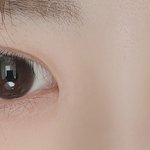 [꼭조언부탁] 눈 성형 4개월전 <b>짝눈</b> 진지하게고민