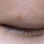 나 쌍수 <b>티나</b> ??