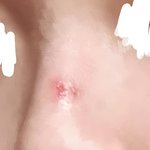 [19] (혐주의)나 어떡해 진짜 망했는데