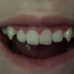 나 사실 ㅂㅍㅇㅇ야....... 하