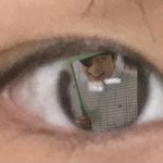 나 <b>꼬막눈</b> 많이 심하냐..
