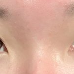 [19] 얘들아 나 <b>쌍수</b> 해야겠지