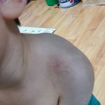 어린이집 아동학대 의심으로 신고<b>절차</b>.. 어떻게 해야할가요?