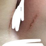 ㅅㅂ 컨버스신었는데 ㅈㄴ쓸림