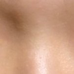 [사진ㅇ] <b>저</b> <b>눈</b>은 앞트임 하는거 어떻게 생각함 ?