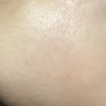 얘들아 ... 피부에 <b>요철</b>???? 이거 아떻게해야함..ㅠ