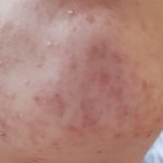 <b>어니</b>증말 피부의신 없냐 (혐주의)