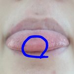 혀가 이상합니다 제발도와주세요!!!!!!!