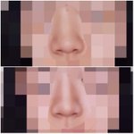 친구 코<b>쉐딩</b> 어때