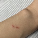 [이것좀봐줘] 애플워치 상처, 애플의 어이없는 <b>응대</b>