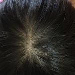 얘들아 나 이거 <b>탈모야</b>...?