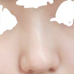 [드루와] 나같은 <b>코</b>는 뭔 수술해야돼?