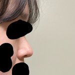 [<b>사진</b>ㅇ] 나 <b>코</b> 어떤 거 같아