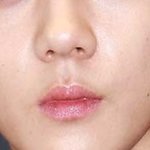 [댓글부탁해] 나 ㄹㅇ 하관 <b>이러</b>케 생겼는데 성형 머해야됨