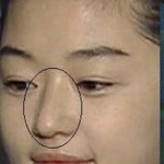 나 오늘 성형<b>외과</b> 상담하러 여러군대 갔는데
