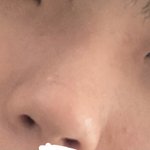 ㄹㅇ 나보다 코 <b>정면</b> 측면 차이나는애 있냐