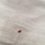 혐) 피어싱 <b>한곳</b>에서 이거 나왔는데 뭐야