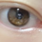 [댓글부탁해] 아니 커가면서 <b>눈동자색</b> 밝아질수있냐