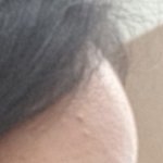[뷰티톡] 나 <b>이마</b> 개못생김