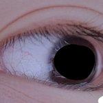 [댓글부탁해] 쌍수<b>며칠</b>차인지 맞춰봐