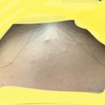 약혐?<b>인가</b> 하여튼 나 ㅜㅜ 피부 이거 어떡해 도와주라