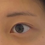 나 쌍수할건데 <b>이</b> <b>눈</b>에서 임보라<b>눈</b> 가능할까?