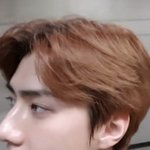 피부미남 <b>세훈이</b> 보고가세요