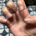 [꼭조언부탁] <b>손톱</b>에 염색약 물든거
