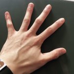 [BTOB] 처음부터 끝까지 귀엽냐고 왜