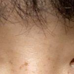 남자인데 눈 수술하고 싶어요 ㅜ