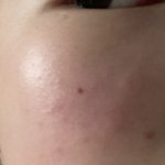 [19] 이거 알려주면 시험 <b>올</b>1등급받음 ㅈㅂㅈㅂㅈㅂㅈㅂㅈㅂ