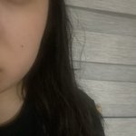 내 <b>턱</b> <b>필러</b> 맞으면 괜찮아질까?