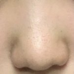 [댓글부탁해] 나 복코 많이 <b>심해</b>?