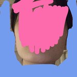 [ㅈㄱㄴ] 사각턱 스트레스인데 안면윤곽 할까말까 ?