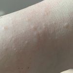 얘들아 나 <b>손목</b>에 두드러기?났는데 왜이려ㅠ