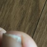 이거 발구락에 뭐임?<b>내성</b>발톱?