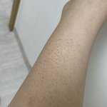 [댓글부탁해] 나 이거 다리 왜그런거임??..(약혐주의)