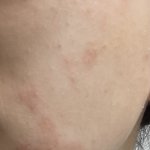 [댓글부탁해] 피부 왜이러는지 아는<b>사람</b> ㅠㅜ <b>제발</b>