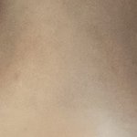 웃을때 <b>눈</b>이 ㅇㅈㄹ되는데 <b>수술</b>밖에 답없?