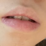 나 토끼이빨 많이 <b>심해</b>?