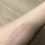 [NCT즌] ㅅㄷ 요가링 원래 <b>이럼</b>?