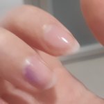 [ㅈㄱㄴ] 손톱에 <b>볼펜</b>액 물들었음ㅋㅋㅋㅋㅋㅋ