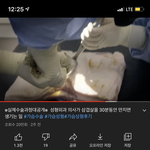 [조언부탁해] 여친 가슴수술 동의해야하나요