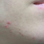후ㅜ 나 용돈으로 화장품 플렉스 했는데 여드름 다 박살나면 좋겠다...