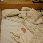 모텔에서 피묻은 침대에서 잤어요 (사진혐)