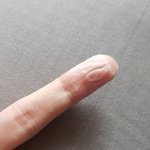 밴드 뗀 손가락 봐 ... 혐오주의