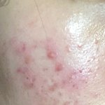 [댓글부탁해] 헤이네ㅇㅊ 어성초 <b>토너</b> 조음?