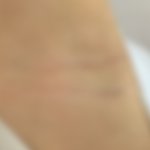 [겨드랑사진] 겨드랑이에 <b>주름</b>? 나만 있냐 진짜