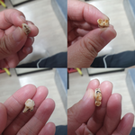 [방탈죄송] 인천 중국<b>집</b> 음식에서 사람 치아가 나왔습니다 (사진<b>O</b>)